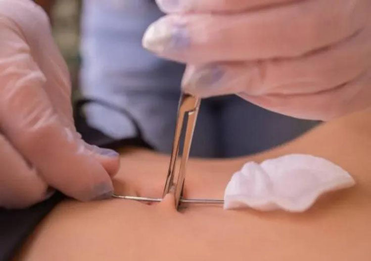 Precautions and maintenance knowledge for navel piercing